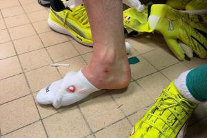 舍瓦利耶談被踢傷：有時候有些動作必須避免，今天我算是非常幸運