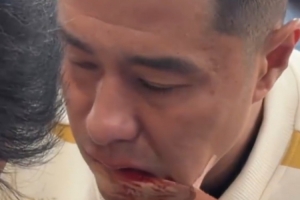 硬漢！國(guó)安足協(xié)杯奪冠后，侯森在場(chǎng)邊默默處理嘴部傷口