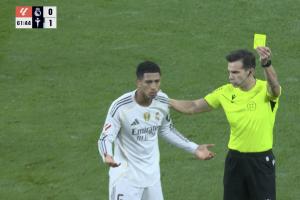 沒給牌！貝林頭部遭肘到出血，之后反因未經(jīng)允許入場染黃